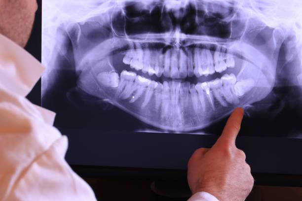 Best Emergency Gum Treatment in Seymour, WI