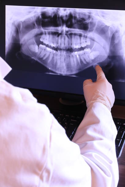Best Emergency Wisdom Teeth Removal in Seymour, WI